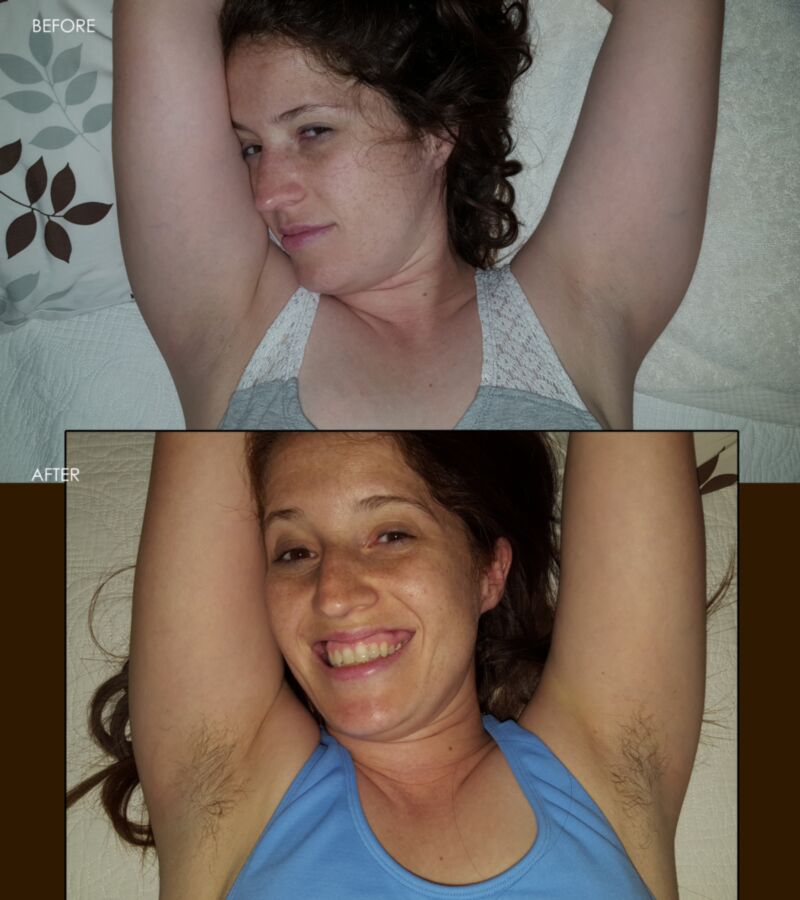 Free porn pics of Hairy Armpits - BEFORE AND AFTER 8 of 8 pics