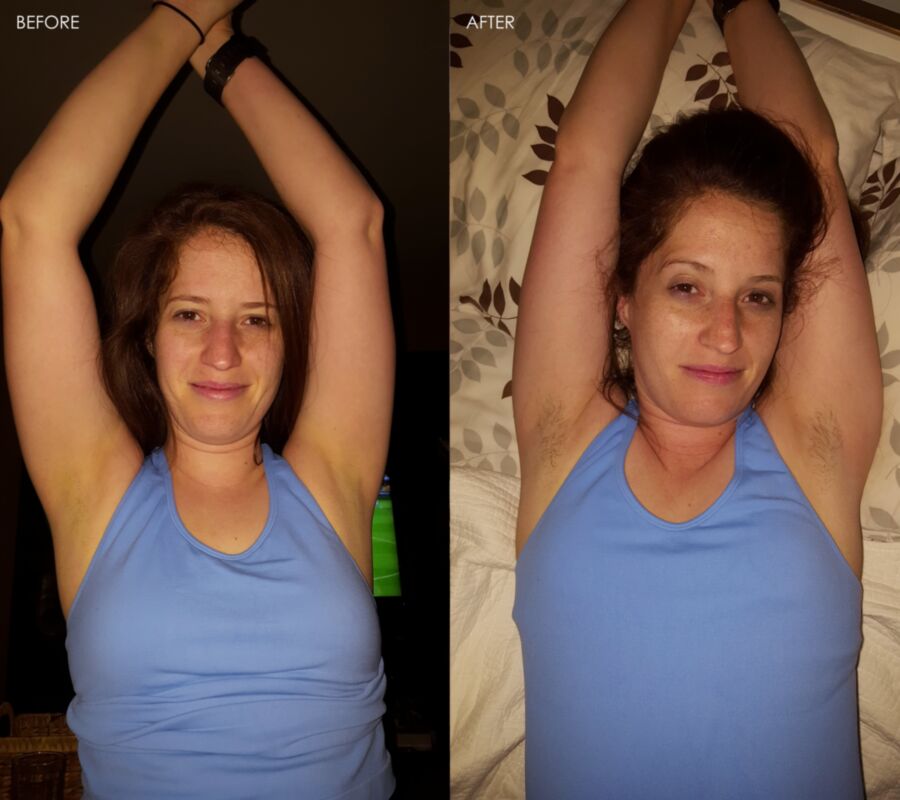 Free porn pics of Hairy Armpits - BEFORE AND AFTER 1 of 8 pics