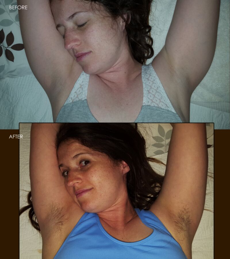 Free porn pics of Hairy Armpits - BEFORE AND AFTER 7 of 8 pics