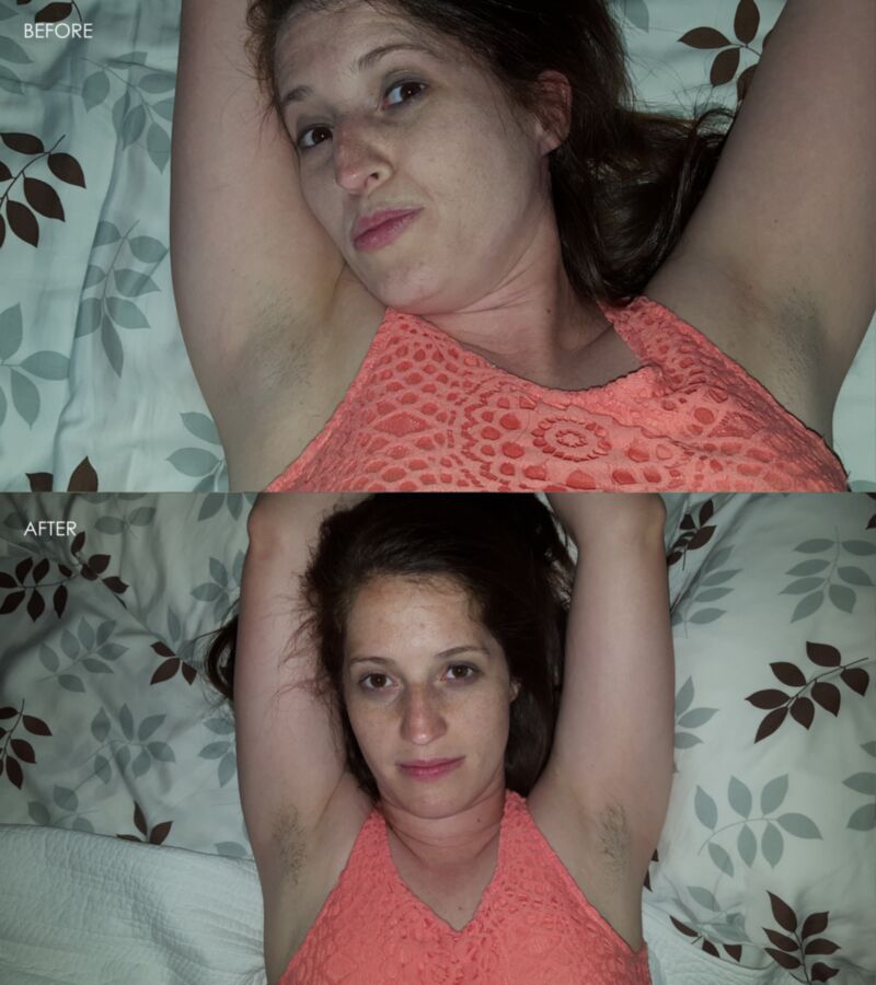 Free porn pics of Hairy Armpits - BEFORE AND AFTER 6 of 8 pics