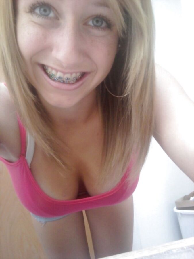 Free porn pics of Hotties In Braces 8 of 19 pics