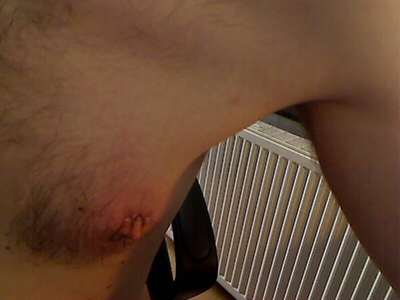 Free porn pics of nipple torture - sharp clamps biting away 20 of 23 pics