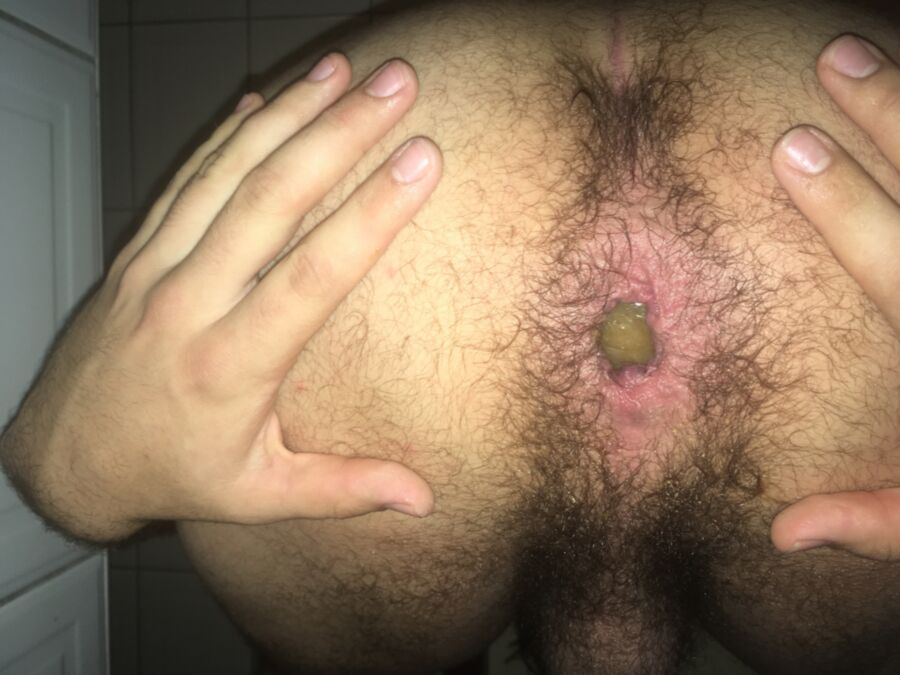 Free porn pics of My hole all loose. 2 of 8 pics
