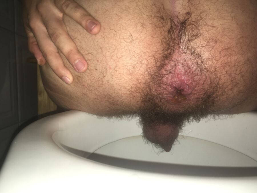 Free porn pics of My hole all loose. 1 of 8 pics