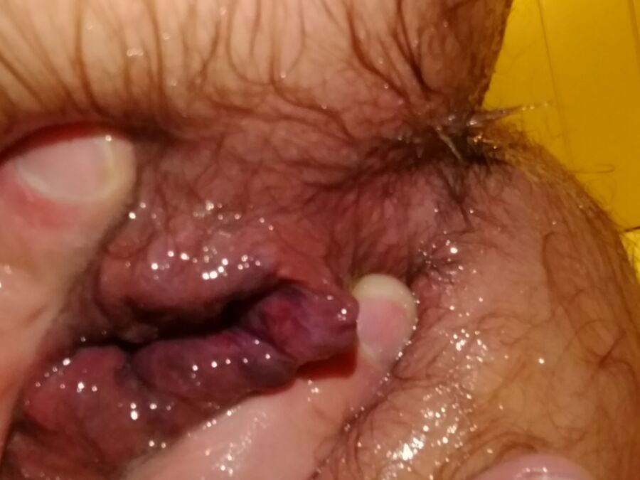 Free porn pics of My Anus 8 of 38 pics