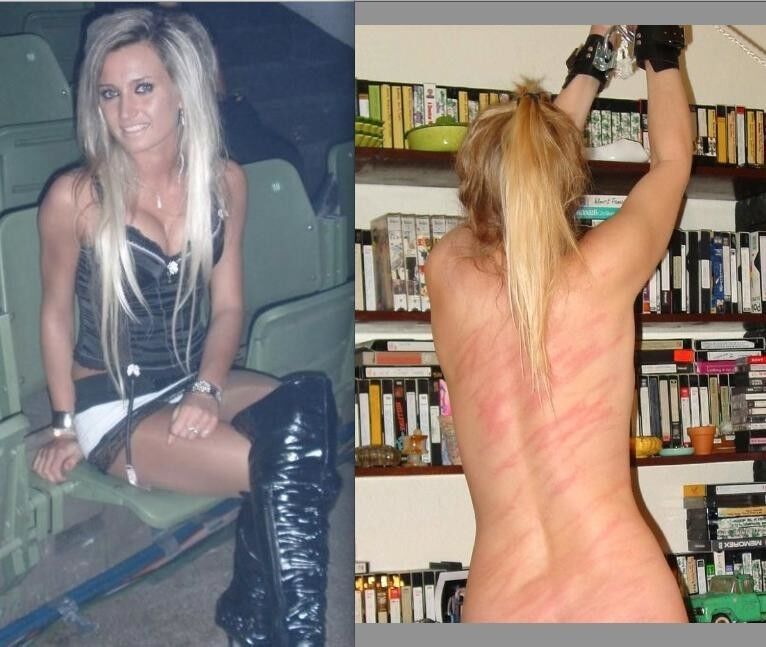 Free porn pics of Before After Bondage 11 of 49 pics