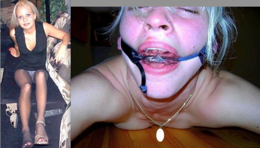 Free porn pics of Before After Bondage 1 of 49 pics