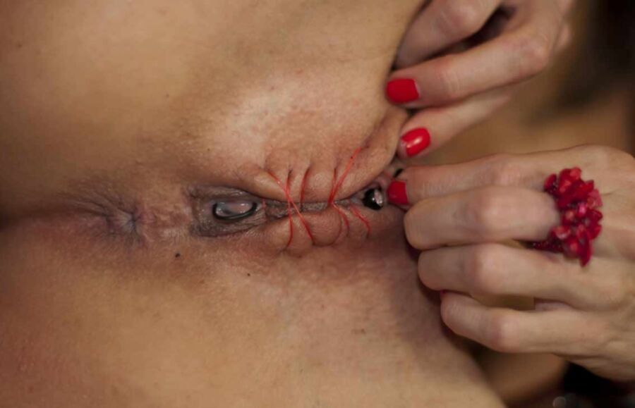 Free porn pics of Infibulation & Clitorectomy VIII 12 of 55 pics