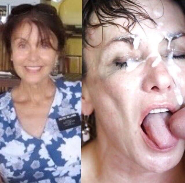 Free porn pics of Before and after facials  1 of 10 pics