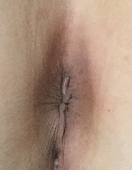 Free porn pics of my wife asshole 2 of 6 pics