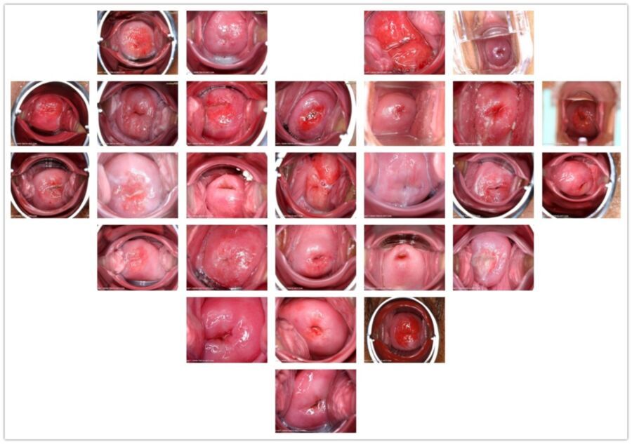 Free porn pics of cervix 4 of 4 pics