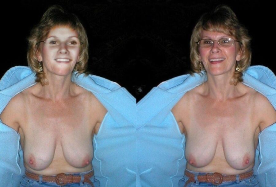 Free porn pics of Stitched Face Dressed and Undressed Then and Now  13 of 56 pics
