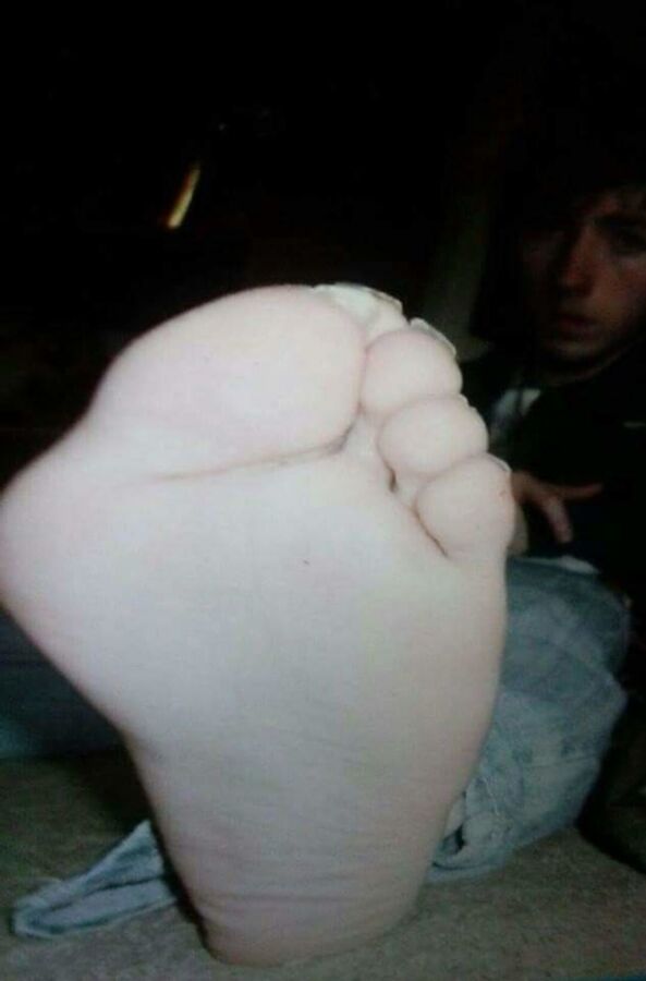 Free porn pics of Male Bunion Feet (random) 4 of 78 pics