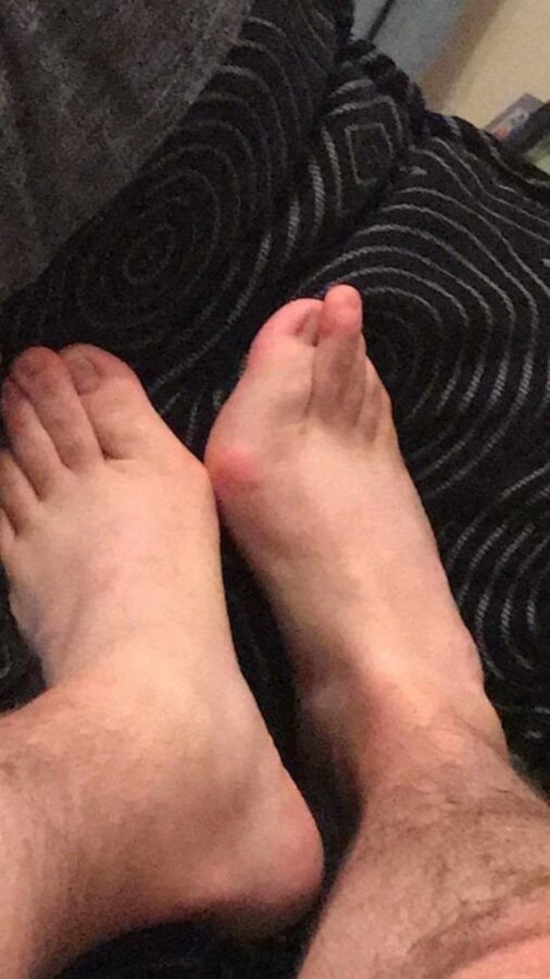 Free porn pics of Male Bunion Feet (random) 11 of 78 pics