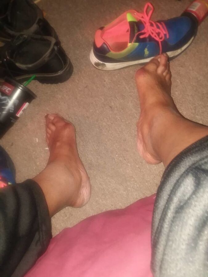 Free porn pics of Male Bunion Feet (random) 15 of 78 pics