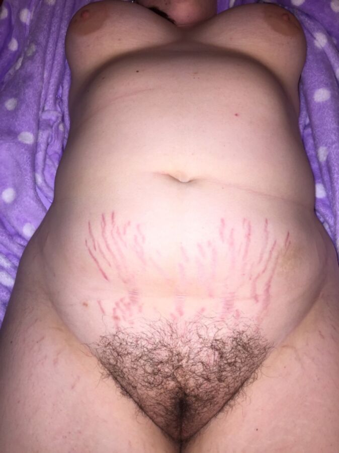 Free porn pics of They have strechmarks and wants sex 1 of 28 pics