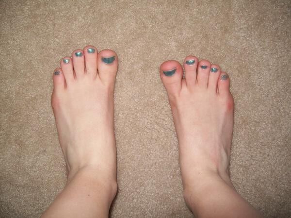 Free porn pics of Green toenails 1 of 2 pics