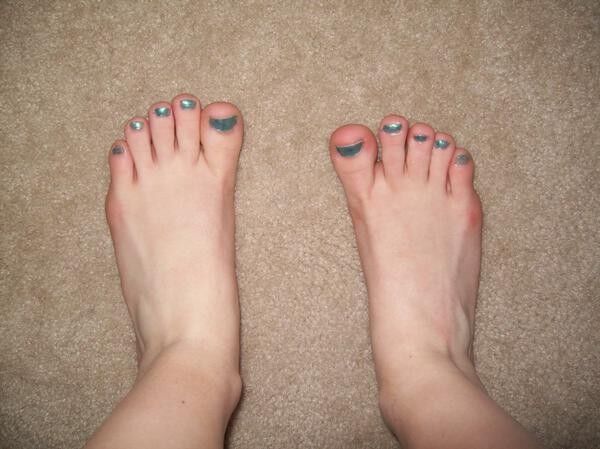 Free porn pics of Blue toenails 1 of 5 pics