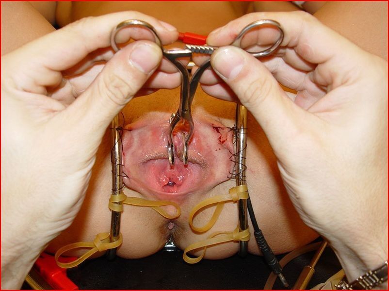 Free porn pics of clinictorture 18 of 18 pics