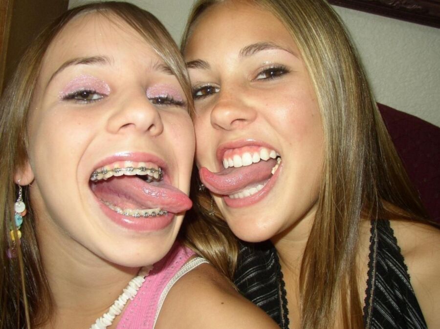 Free porn pics of Braces Images 9 of 65 pics