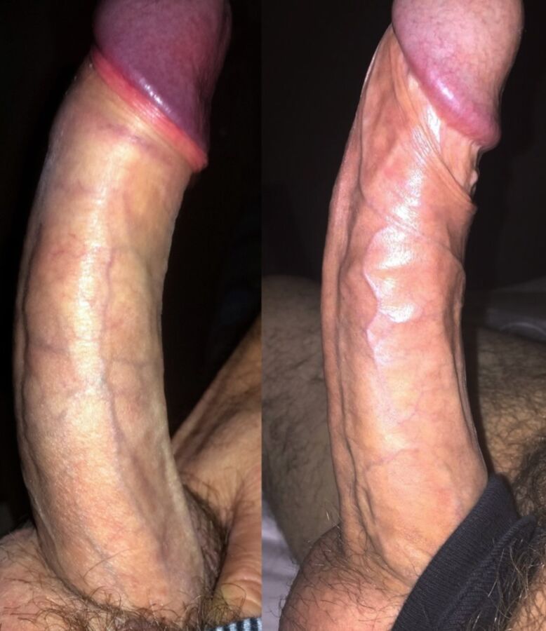 Free porn pics of My Comparisons 15 of 17 pics