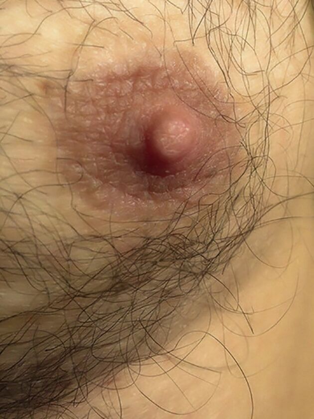 Free porn pics of My Hairy Bits 17 of 30 pics