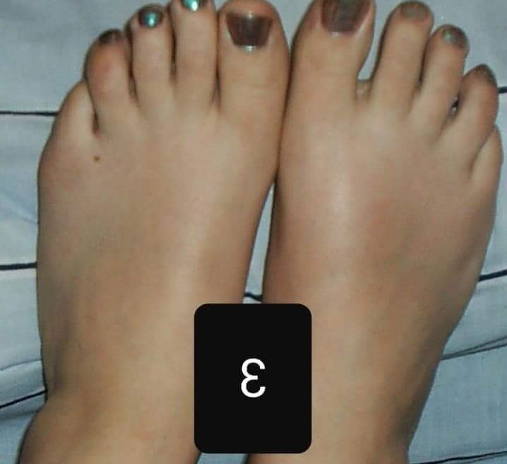 Free porn pics of Pick your favorite pair of feet! x 3 of 10 pics