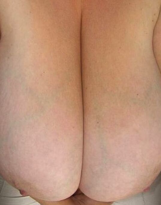 Free porn pics of Huge BBW Tits 4 of 40 pics
