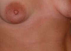 Free porn pics of my saggy tits 1 of 2 pics