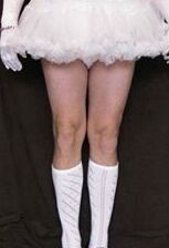 Free porn pics of Peter Went diapered sissy in pretty frilly skirt and kneesocks 7 of 15 pics