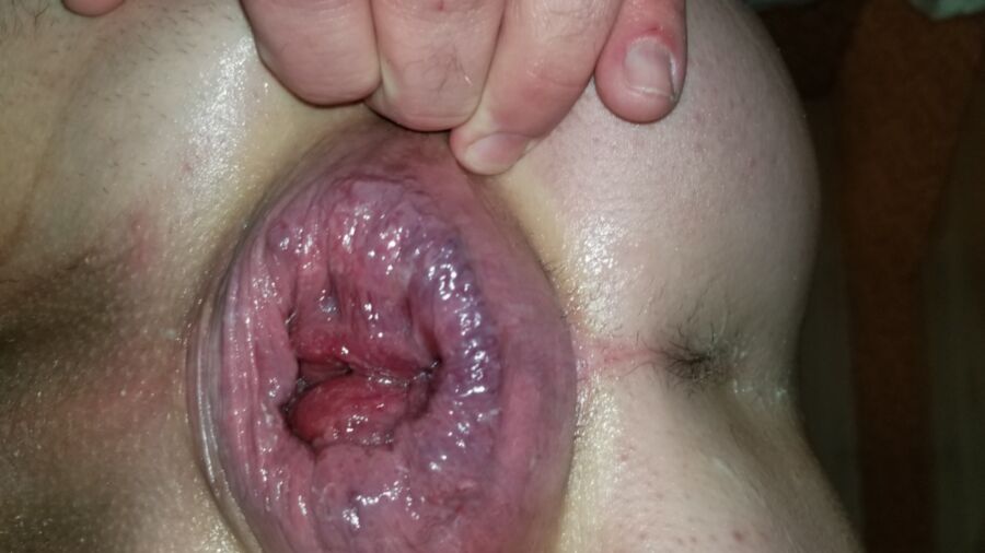 Free porn pics of anal gape 2 of 15 pics