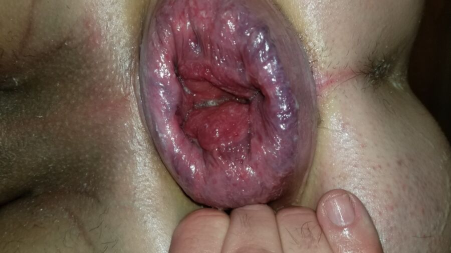 Free porn pics of anal gape 5 of 15 pics