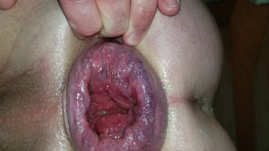 Free porn pics of anal gape 1 of 15 pics