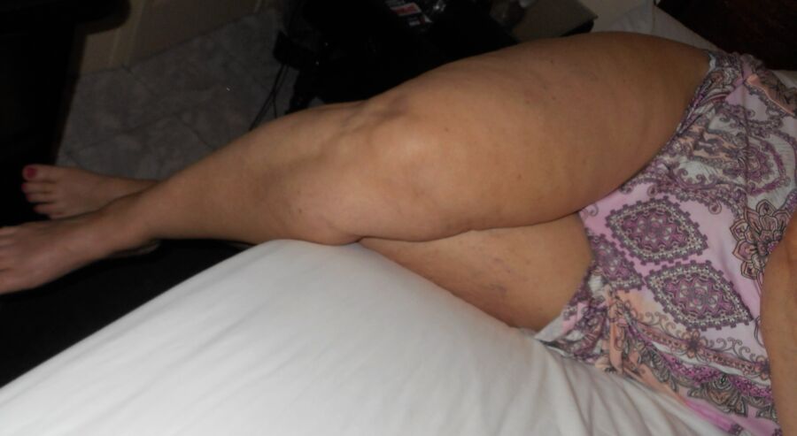 Free porn pics of Cellulite Lovers ll 3 of 7 pics