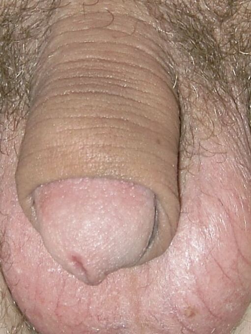 Free porn pics of Pascal zeigt gerne seinen kleinen Penis 2 of 4 pics