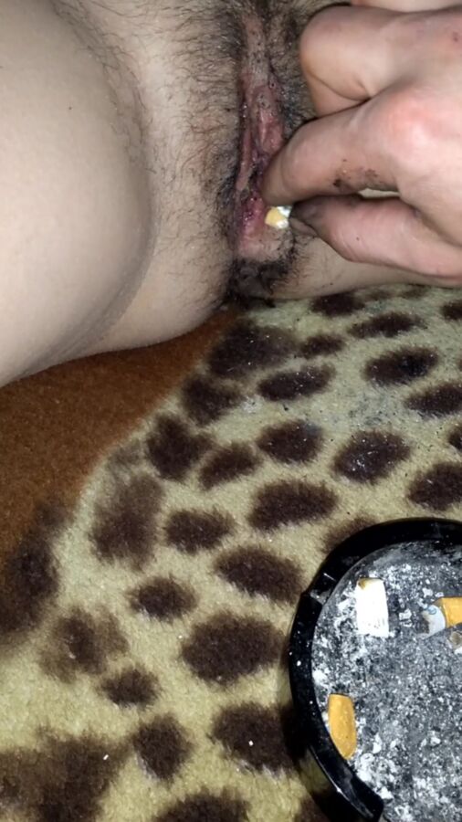 Free porn pics of putting cigarettes ashtray to the pussy 10 of 33 pics