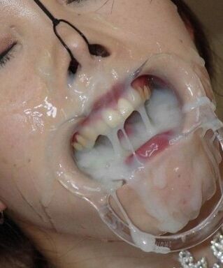 Free porn pics of Kinky Stuff - Dental Gags  7 of 8 pics