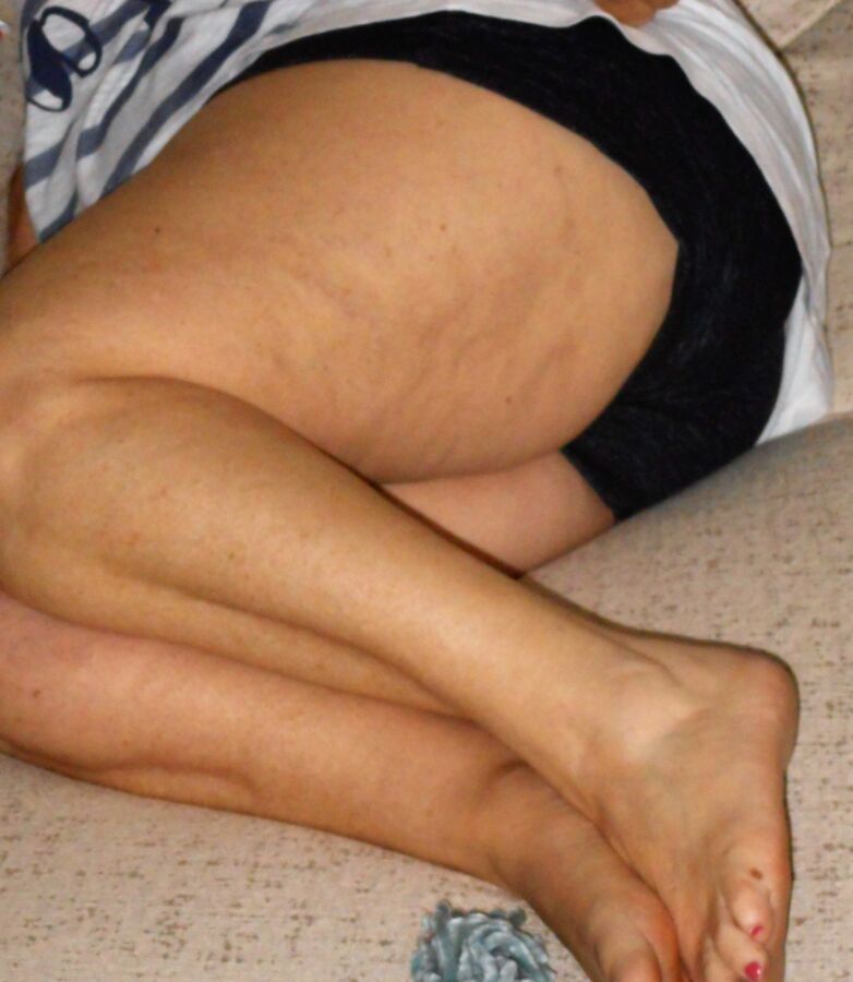 Free porn pics of Legs and Feet, Cellulite 5 of 8 pics