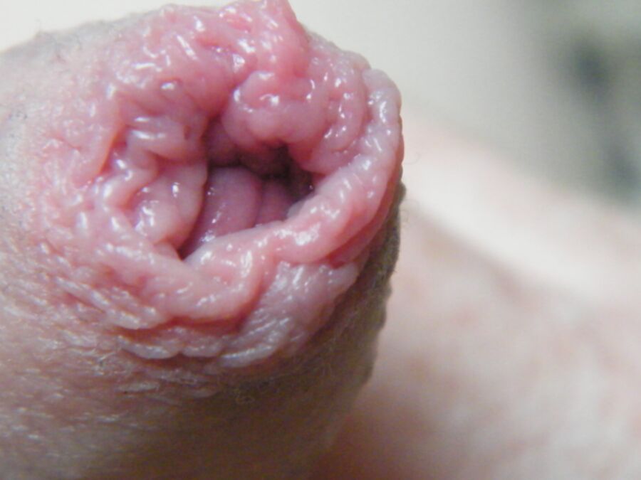 Free porn pics of My Foreskin 6 of 14 pics