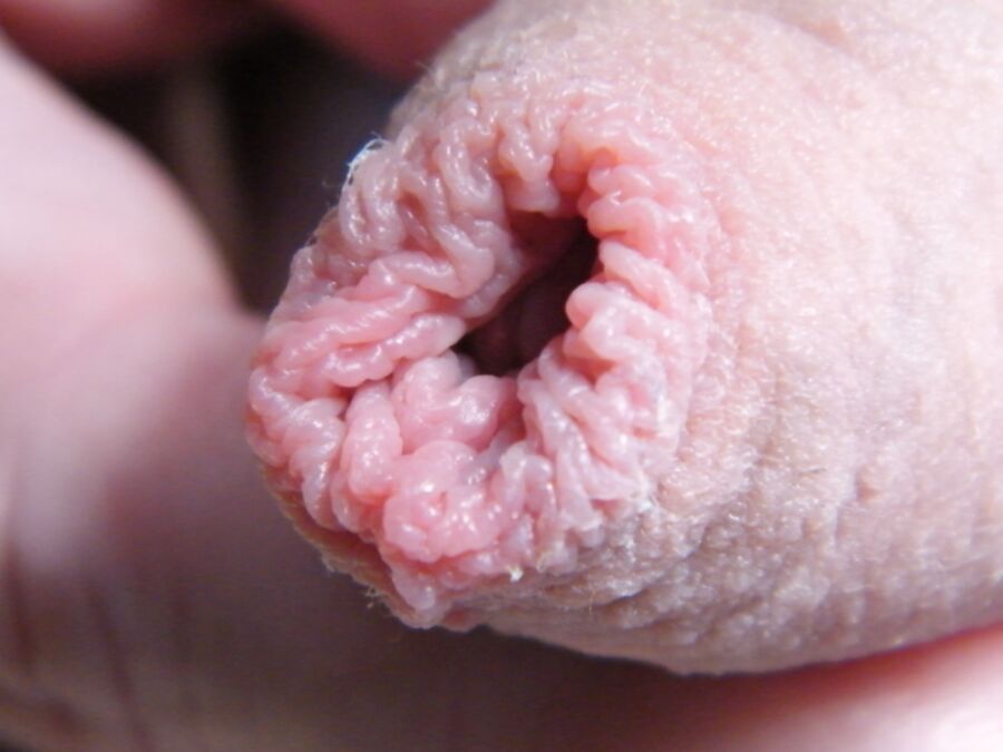 Free porn pics of My Foreskin 5 of 14 pics