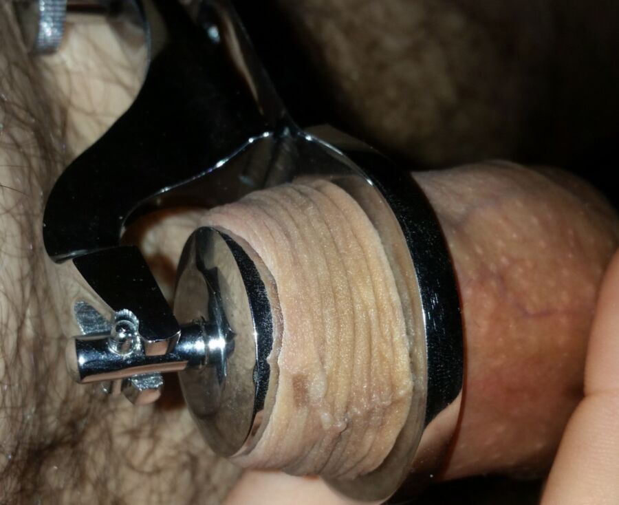 Free porn pics of Beschneidungsklemme/ circumcision clamp 4 of 12 pics