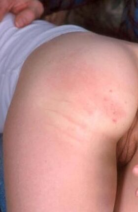 Free porn pics of  Spanking singles - modern - hand spank - close ups 4 of 15 pics