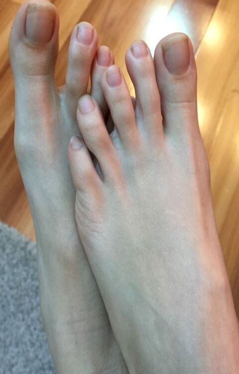 natural toes  7 of 10 pics