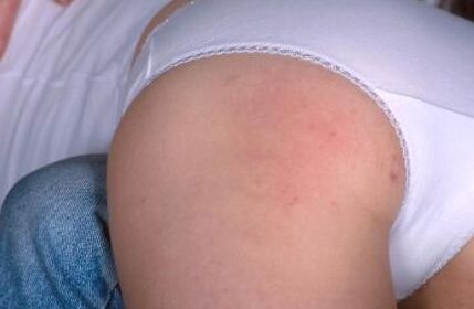 Spanking - Slim blonde takes OTK spanking 20 of 64 pics