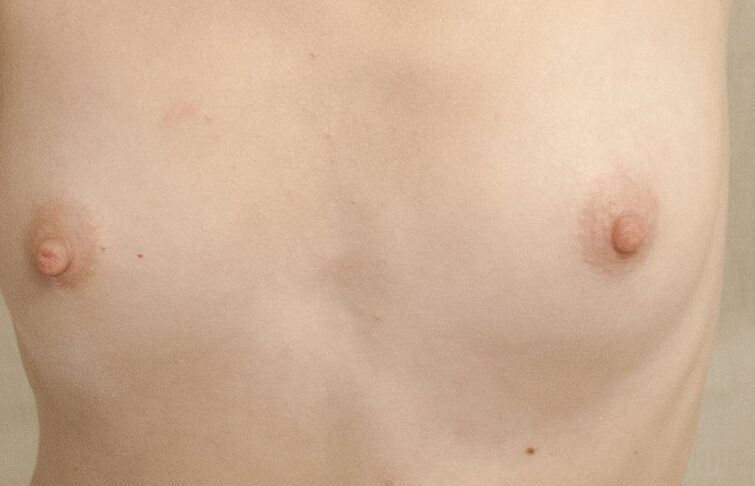 jeunes tetines - young titties 9 of 31 pics