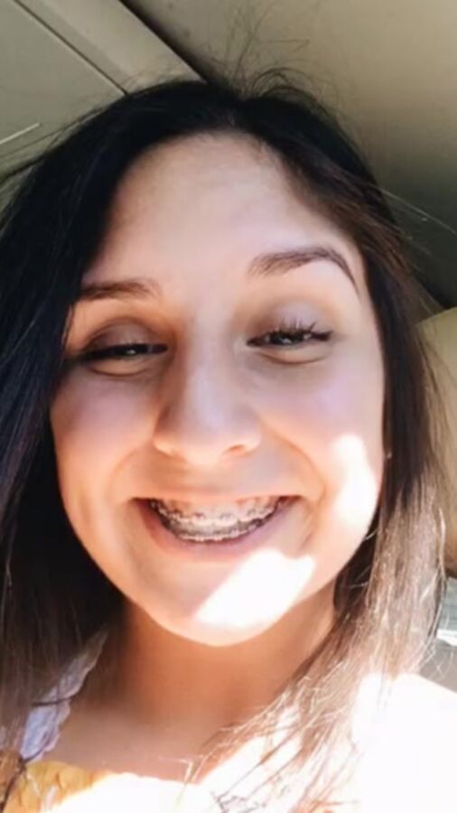 TEEN MONNI WITH BRACES 1 of 18 pics