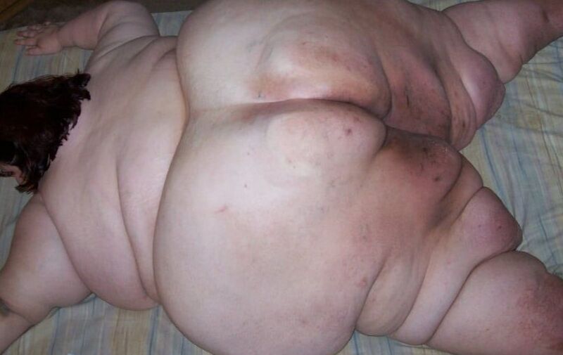 SSBBW With Discolored Skin 5 of 47 pics