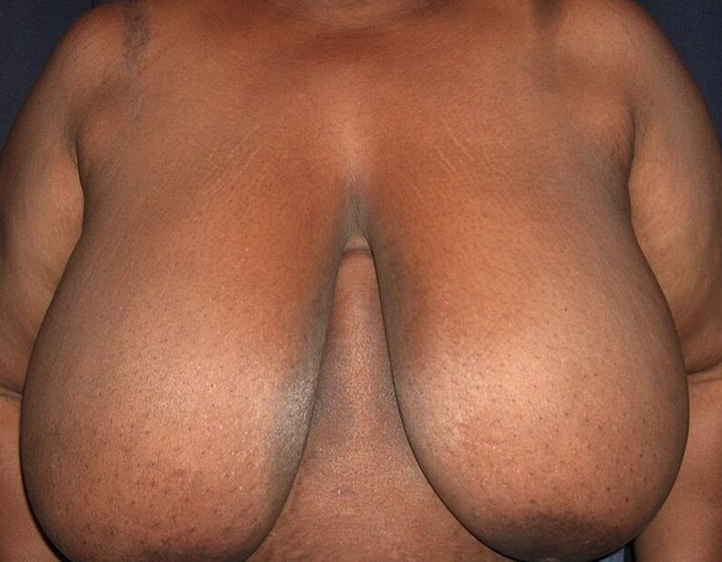 Real, Big Black Boobs 8 of 46 pics