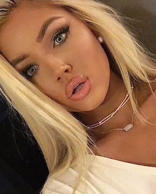 Instagram Teen With Sexiest Lips Ever 5 of 64 pics