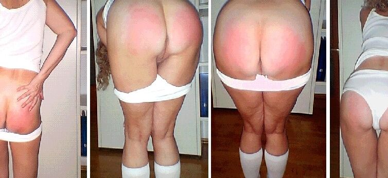 Spanking aftermath 8 of 8 pics